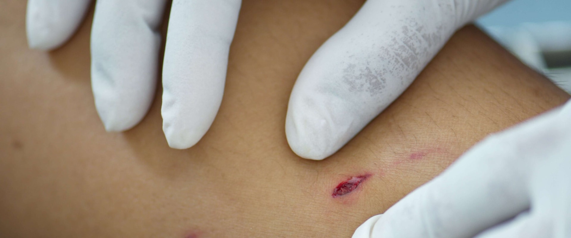 Face Bit The Impact of Dog Bites on Facial Injuries