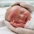 Forceps Delivery Injuries in Newborns: Common Birth Trauma, Warning Signs, Medical Complications, Treatment, and Long-Term Recovery