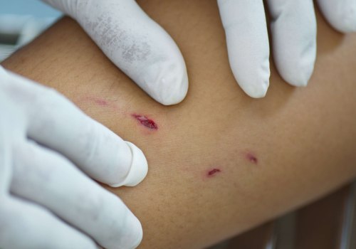 The Impact of Dog Bites on Facial Injuries